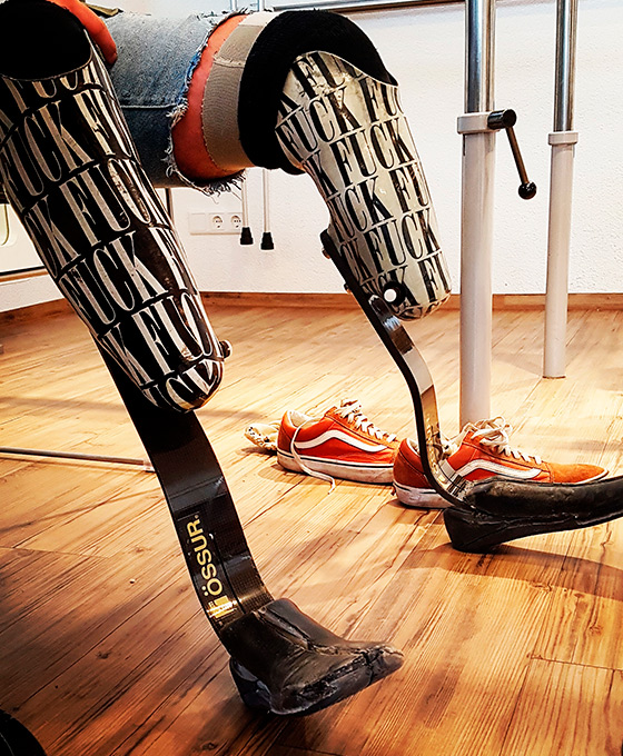 Prótesis personalizadas