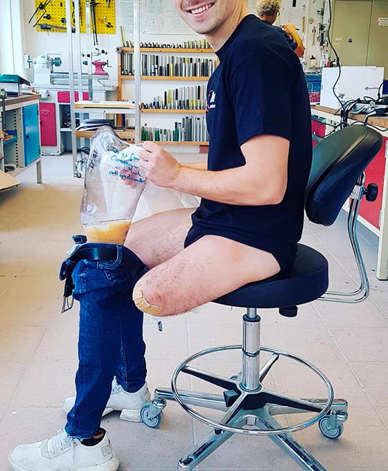 Diseño personalizado de prótesis en Vitoria