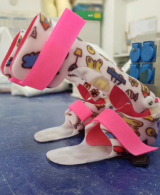 Órtesis pediátricas en Vitoria