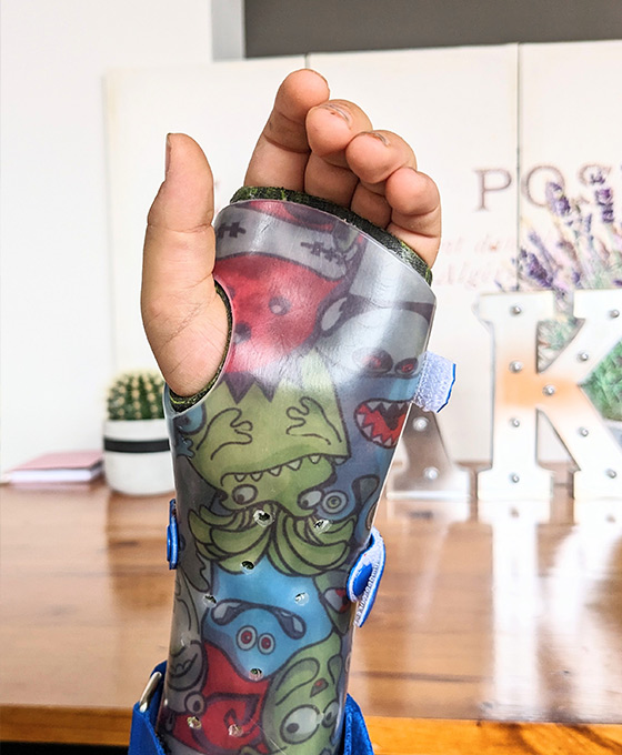 Órtesis adaptadas para niños