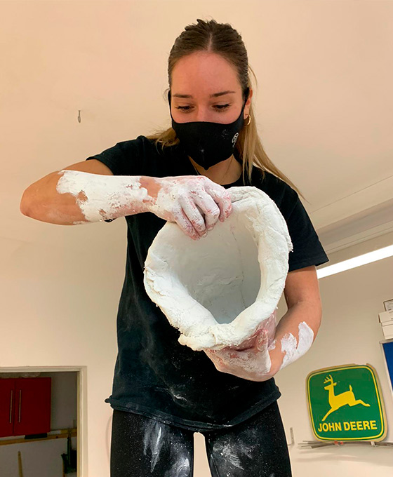 Preparación de prótesis personalizada