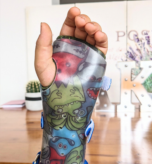 Órtesis adaptadas para niños