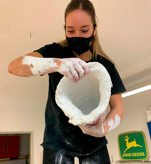 Preparación de prótesis personalizada